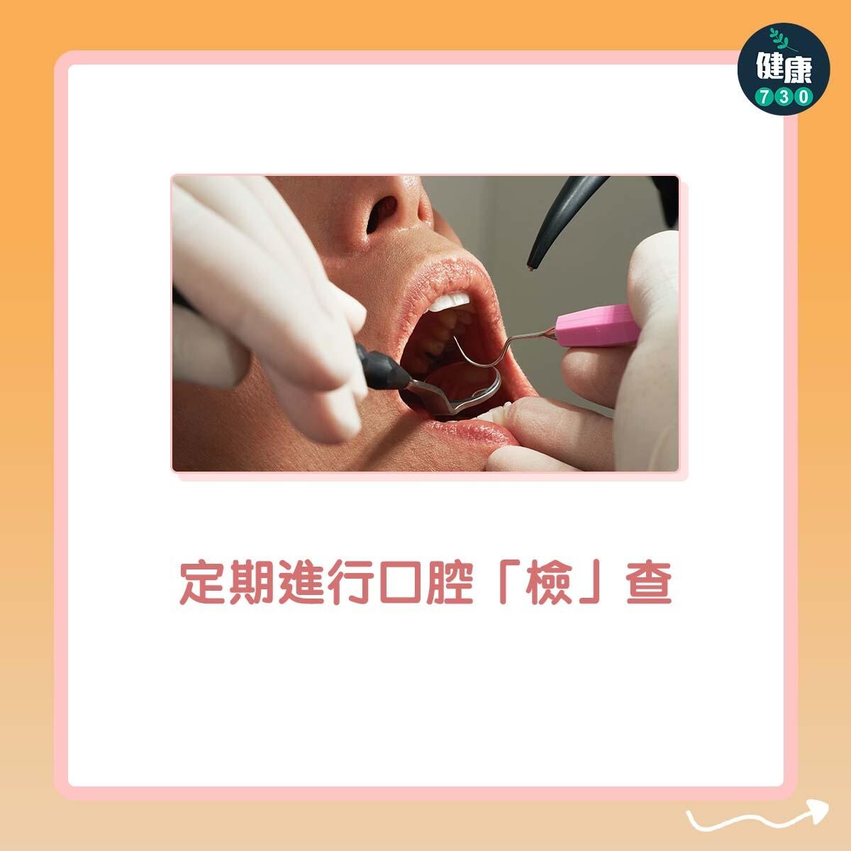 定期進行口腔「檢」查